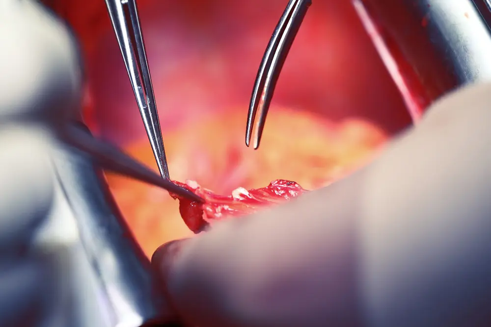 cardiothoracic