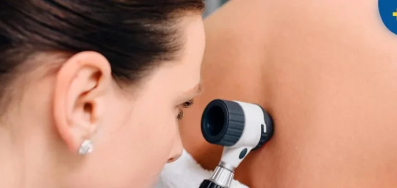 Dermatology