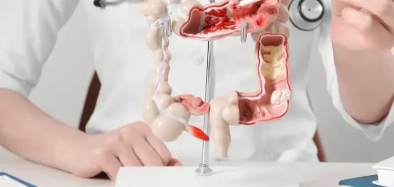 Gastroenterology