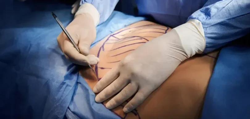Plastic Surgery