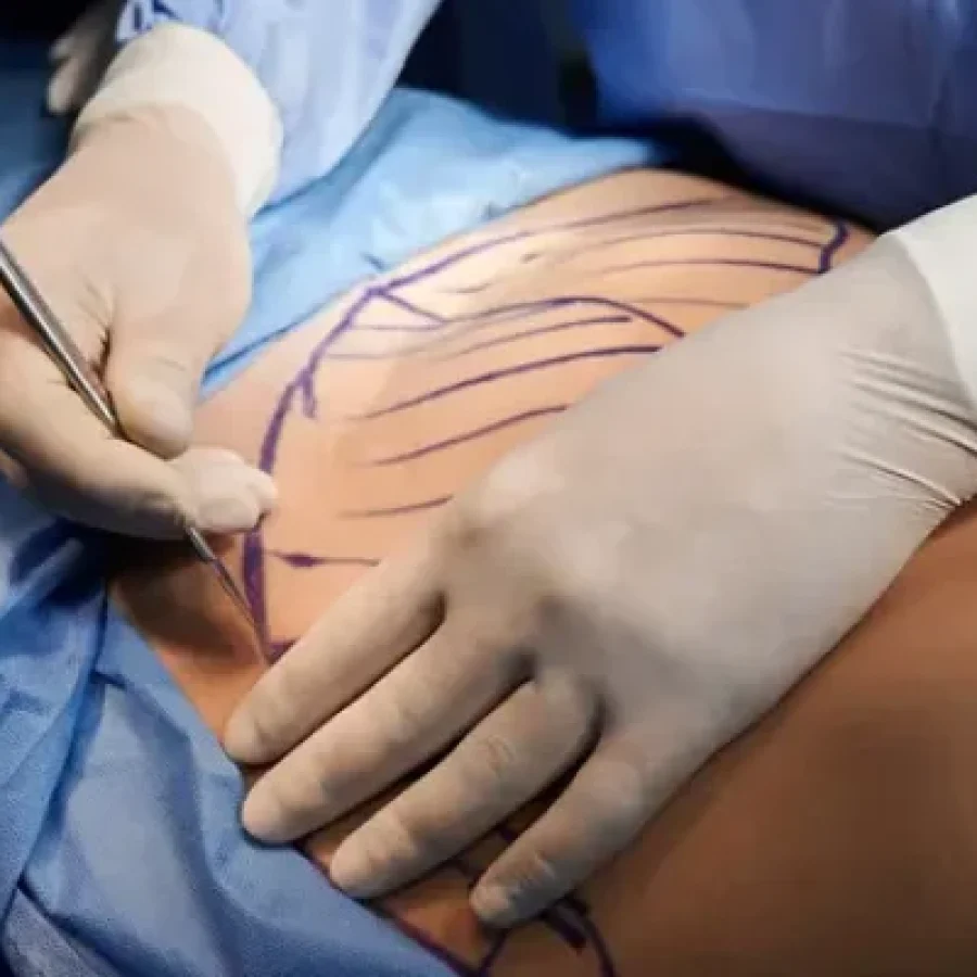 Plastic Surgery