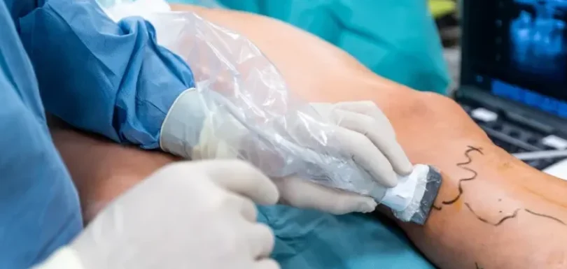 Vascular Surgery