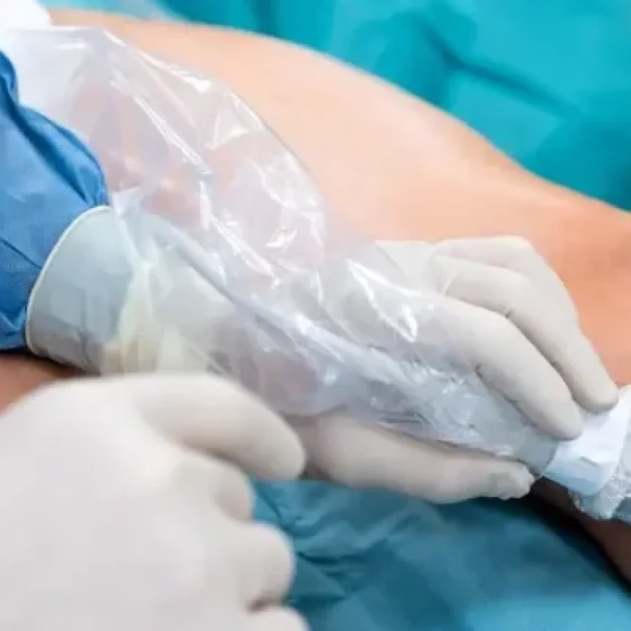 Vascular Surgery